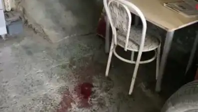 Sandalyeden Düşen Adamın Yaşadığı Korkunç Kaza Görevli Sağlık Ekiplerini Harekete Geçirdi