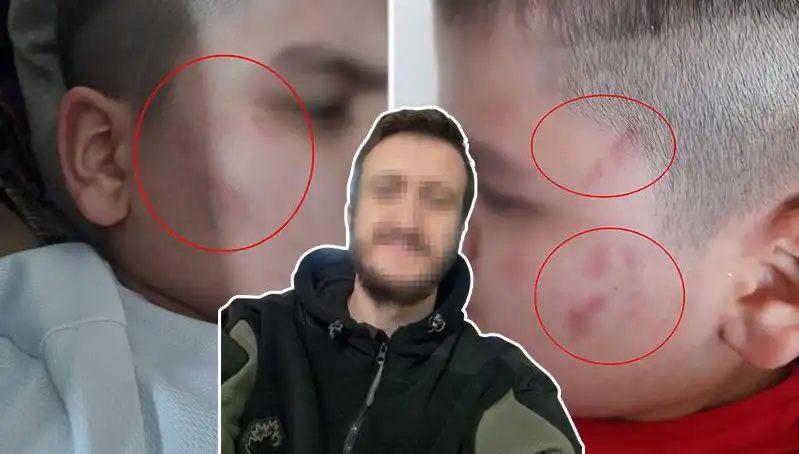 Okulda Otizmli Çocuğa Yapılan Dayak İddiası Aileyi Tedirgin Etti