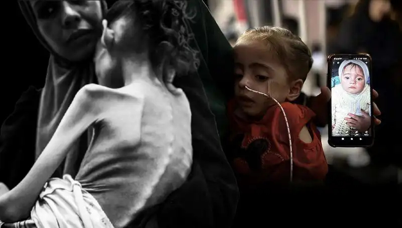 Meryem’in Önündeki Zorlu Mücadele: Açlıkla Savaşan Küçük Bir Hayat