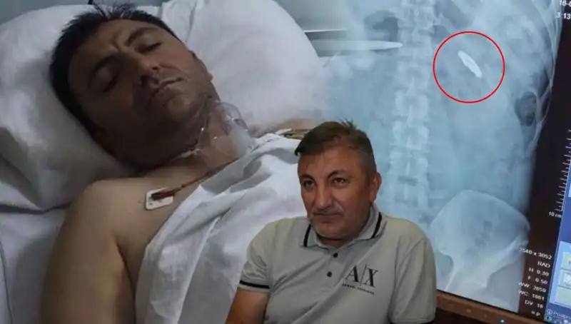 15 Temmuz'un Sıklıkla Unutulan Yüzü: Vücudunda Kurşunla 9 Yıl Yaşamak